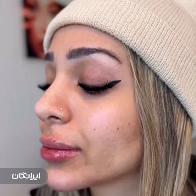 کلینیک زیبایی ژلوکس