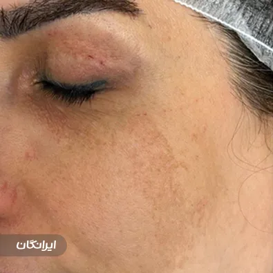 فیشیالیست زرین نازشکرانی