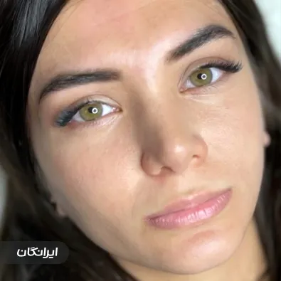 کلینیک زیبایی دکتر شیوا غلامی