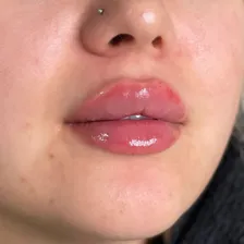 کلینیک زیبایی الیزابت