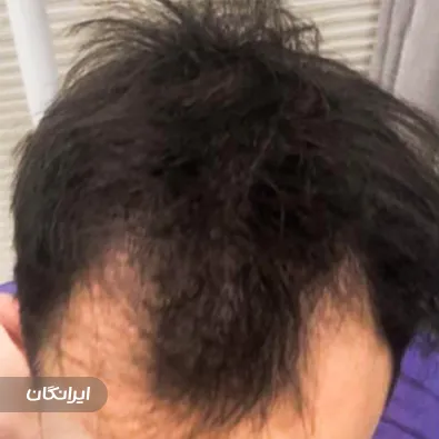 کلینیک کاشت مو فیضی