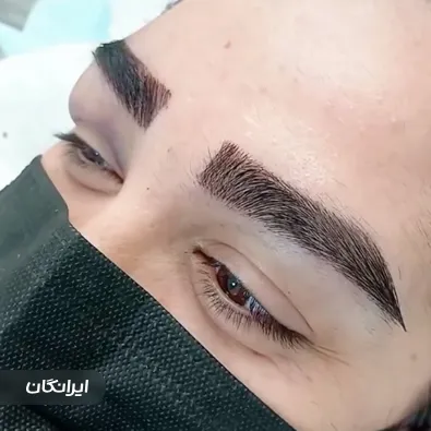 کارشناس کاشت مو مرضیه قاسمی