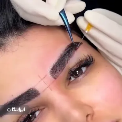 کارشناس کاشت مو مرضیه قاسمی