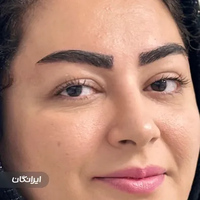 کارشناس کاشت مو یونس بهمنی