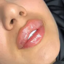 کلینیک زیبایی دی