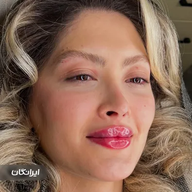 کلینیک زیبایی آرا