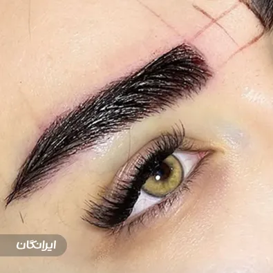 کلینیک زیبایی آسو