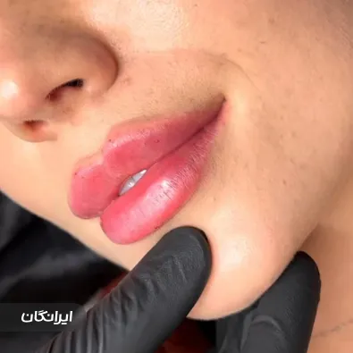 کلینیک زیبایی غزل