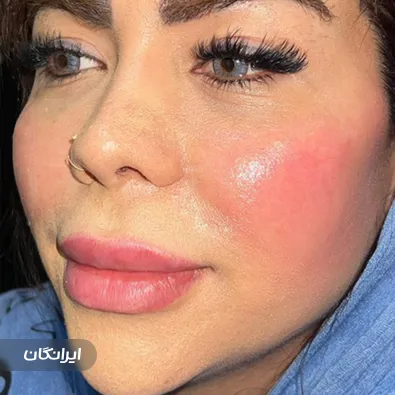 کلینیک زيبايی روشن