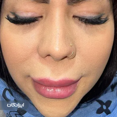 کلینیک زيبايی روشن