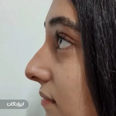 کلینیک جراحی بینی بیوتی