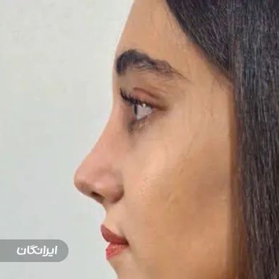 کلینیک جراحی بینی بیوتی