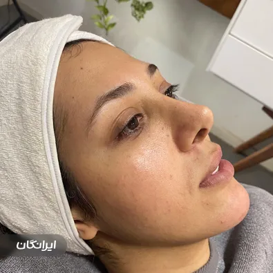 فیشیالیست هانیه تقوی