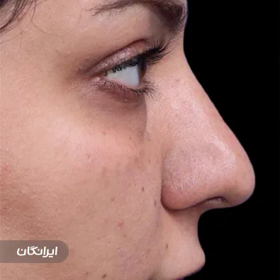 دکتر حسین تقوی