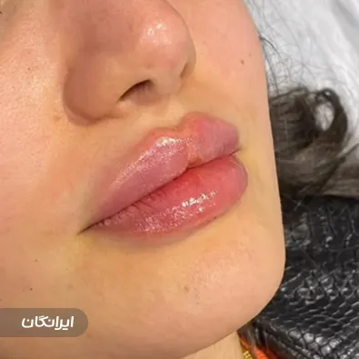 کلینیک زیبایی دکتر آرش طلوع مهر