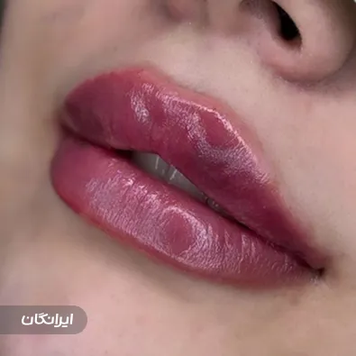 کلینیک زیبایی دکتر معصومه شیروانی