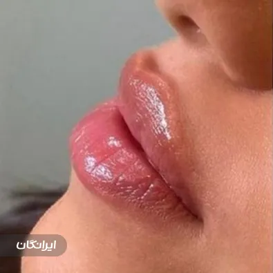 مرکز زیبایی سپید