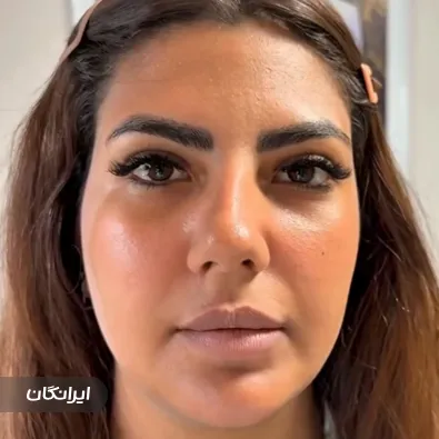 کلینیک زیبایی دکتر میلاد کبیری سامانی