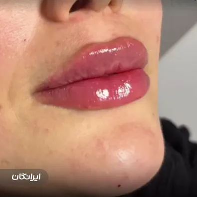 کلینیک زیبایی مه نیا