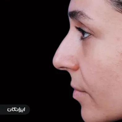 دکتر پیام ابوالحسنی