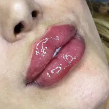 کلینیک زیبایی ژوانا