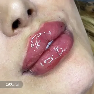 کلینیک زیبایی ژوانا