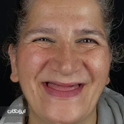 دکتر مهدی خانی