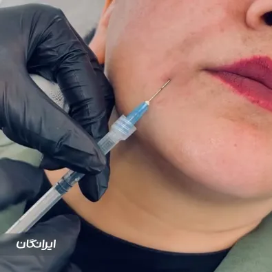 کلینیک زیبایی زر