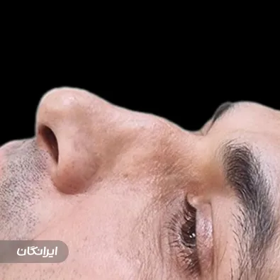 دکتر امید یوسف نژاد