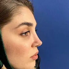 دکتر ندا افسر