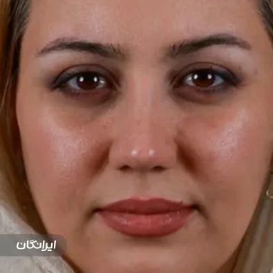 دکتر فرید فریدونی