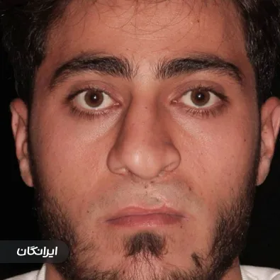 دکتر آرمین اکبری