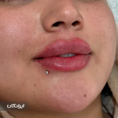 کلینیک زیبایی پینک