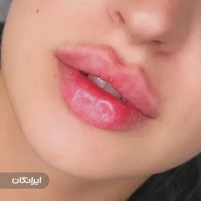 کلینیک زیبایی پینک