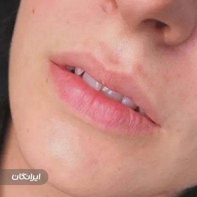 کلینیک زیبایی پینک