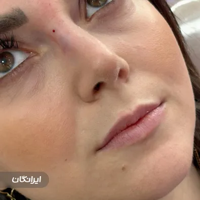 کلینیک زیبایی الماس