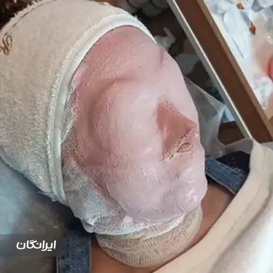 سالن پاکسازی پوست آریل