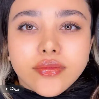 کلینیک زیبایی دکتر فرید حاجی‌ علی