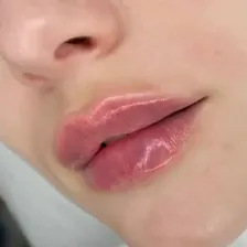 کلینیک زیبایی دکتر فهیمه قنبرپور