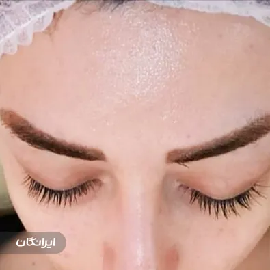 فیشیالیست سپیده فلاحی