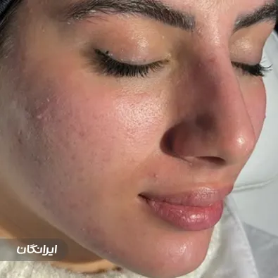 فیشیالیست لاله نیلی پور