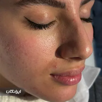 فیشیالیست لاله نیلی پور