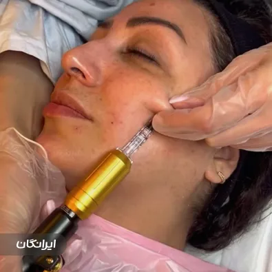 فیشیالیست سیمین اطمینان