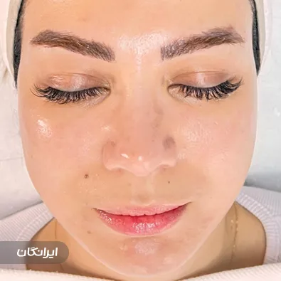 فیشیالیست سمیه حیدری