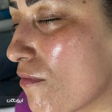 فیشیالیست الناز نظری