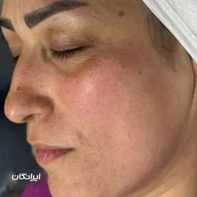 فیشیالیست الناز نظری