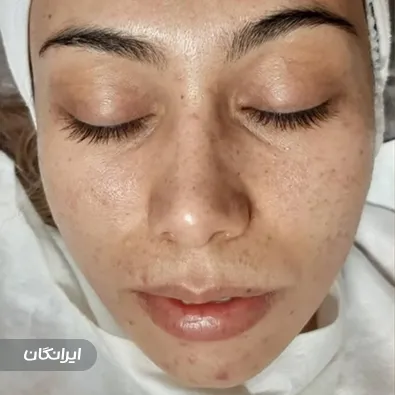 فیشیالیست نسترن حسینی