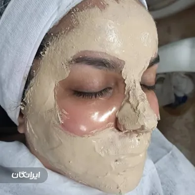 فیشیالیست نسترن حسینی