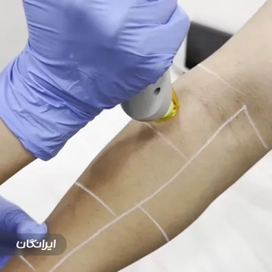 کلینیک زیبایی سون