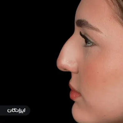 دکتر حسین زادی